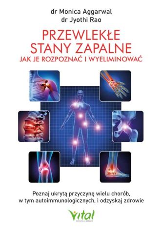 Przewlekłe stany zapalne. Jak je rozpoznać i wyeliminować. Poznaj ukrytą przyczynę wielu chorób, w tym autoimmunologicznych, i odzyskaj zdrowie